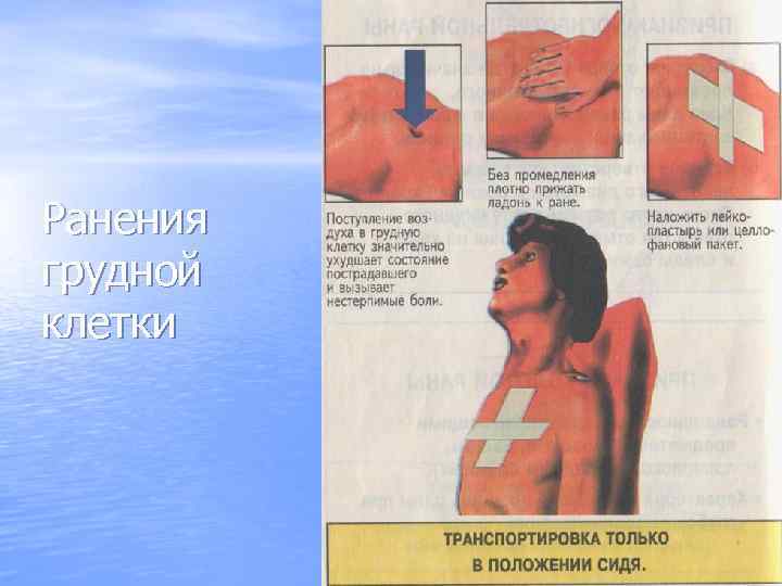 Ранения грудной клетки 