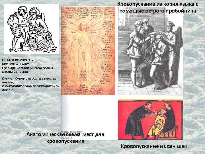 Кровопускание из корня языка с помощью Кровопускание из корня языка с помощью