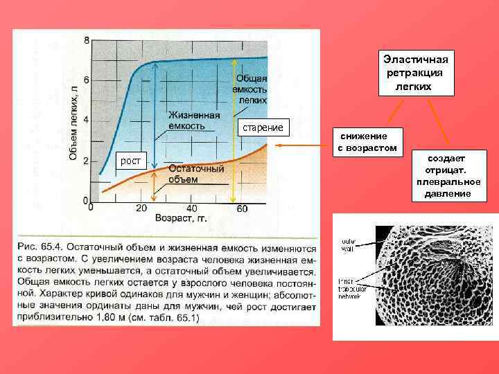      Эластичная      ретракция  