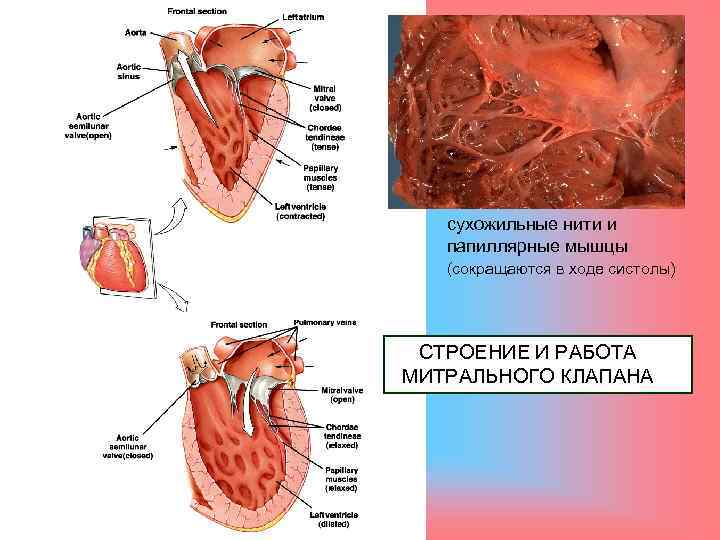 Сосочковые мышцы левого желудочка. Папиллярные мышцы митрального клапана. Папиллярные мышцы левого желудочка строение. Папиллярные мышцы сердца гистология. Сосочковые мышцы митрального клапана.