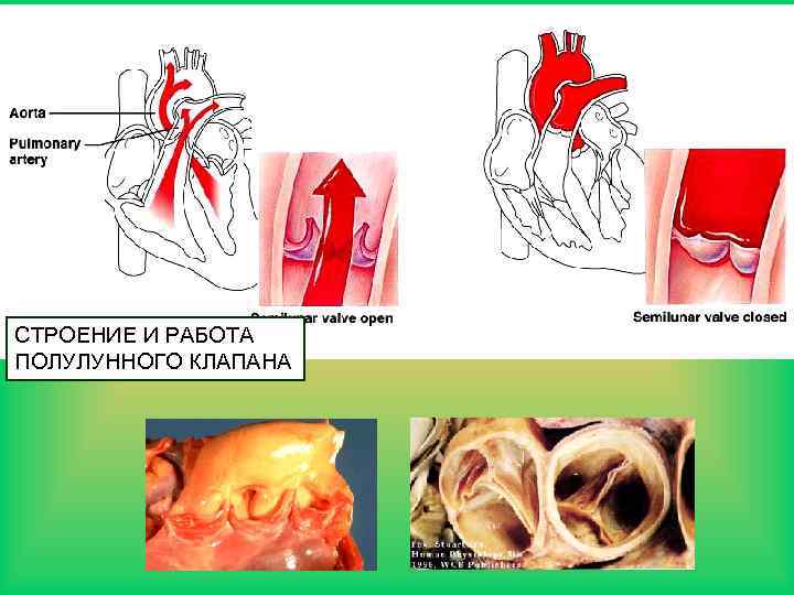 СТРОЕНИЕ И РАБОТА ПОЛУЛУННОГО КЛАПАНА 