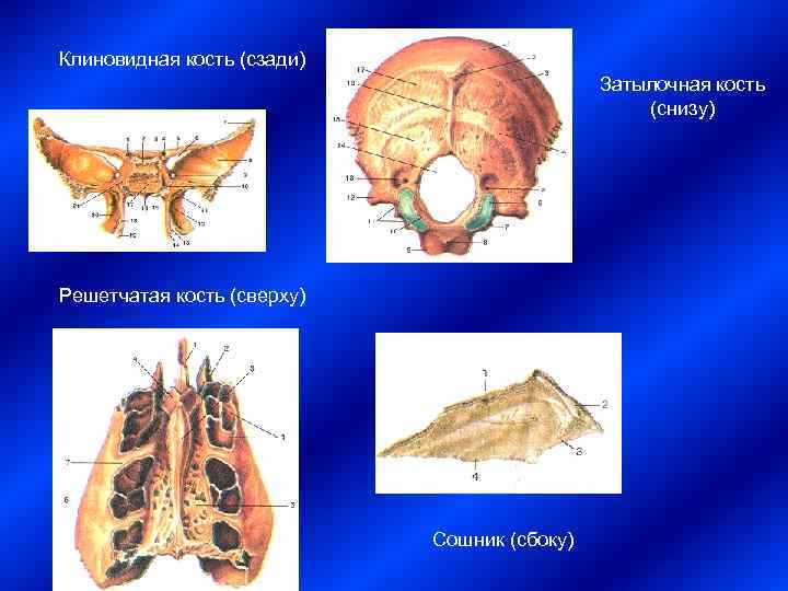Клиновидная кость (сзади)     Затылочная кость     (снизу)