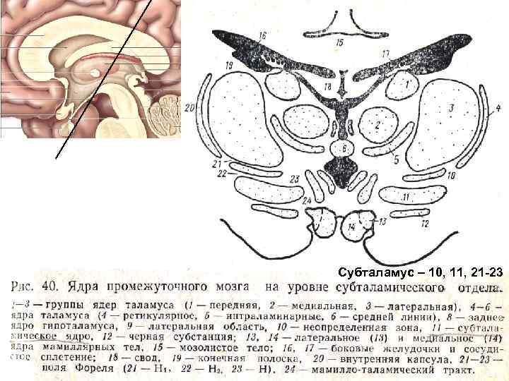 Мозолистое тело картинка