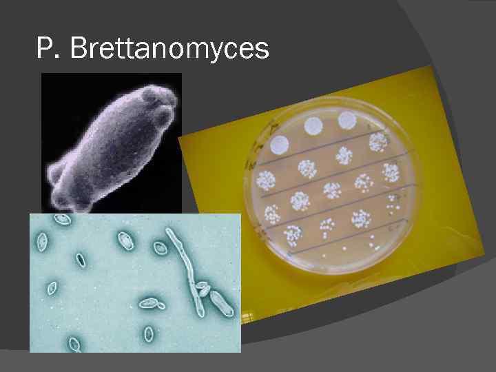 Р. Brettanomyces Р. Brettanomyces