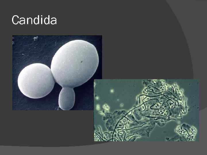 Candida Candida