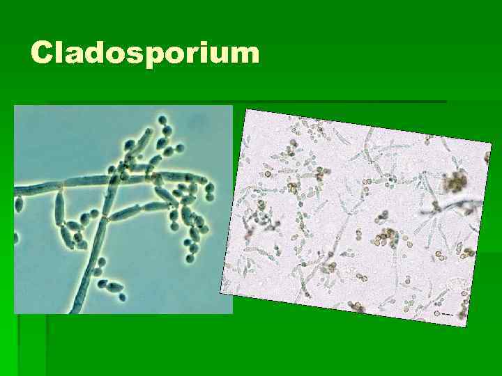 Cladosporium 
