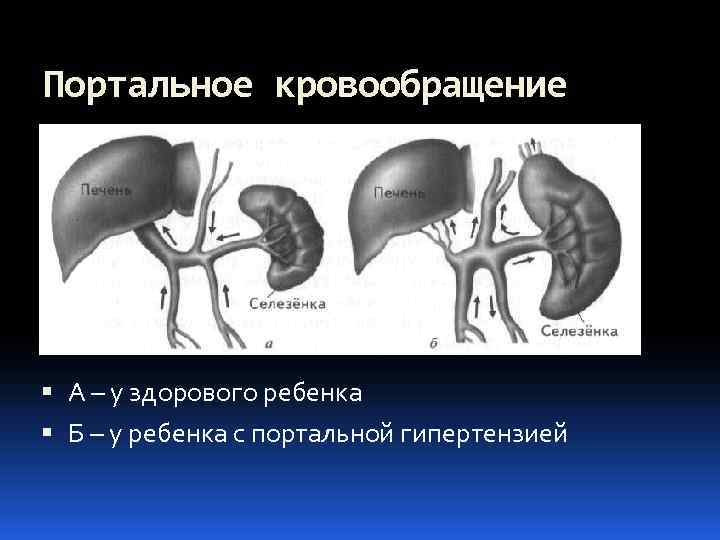 Усиление сосудистого рисунка печени