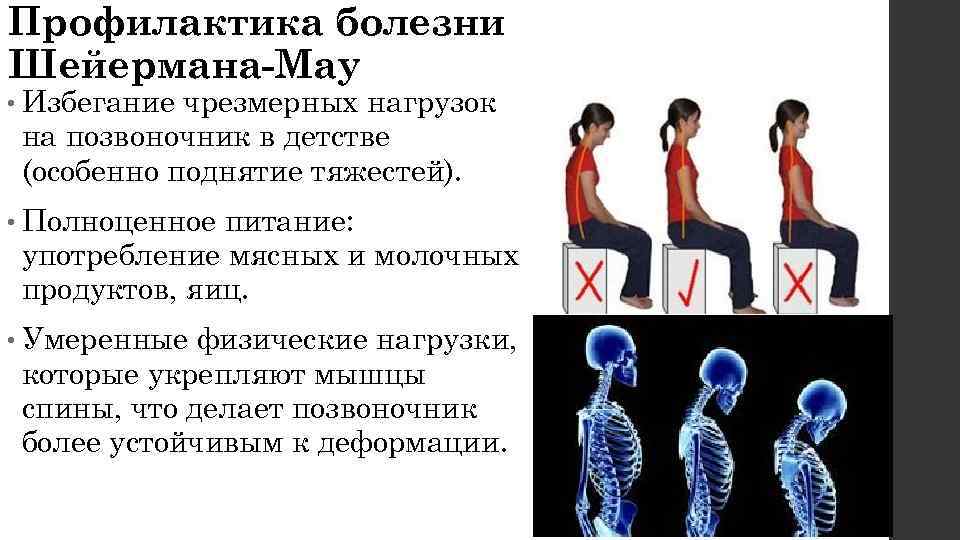 Профилактика болезни Шейермана-Мау • Избеганиечрезмерных нагрузок на позвоночник в детстве (особенно поднятие тяжестей). 