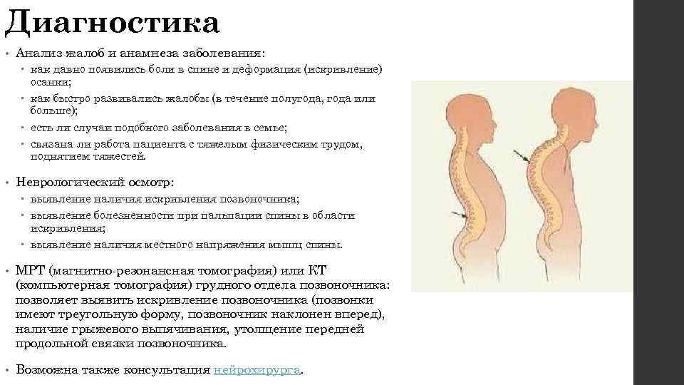 Болезнь мау. Болезнь Шермана позвоночник. Болезнь Шейермана-МАУ анализы. Болезнь Шерман-МАУ описание. Болезнь Шейермана МАУ как наследуется.