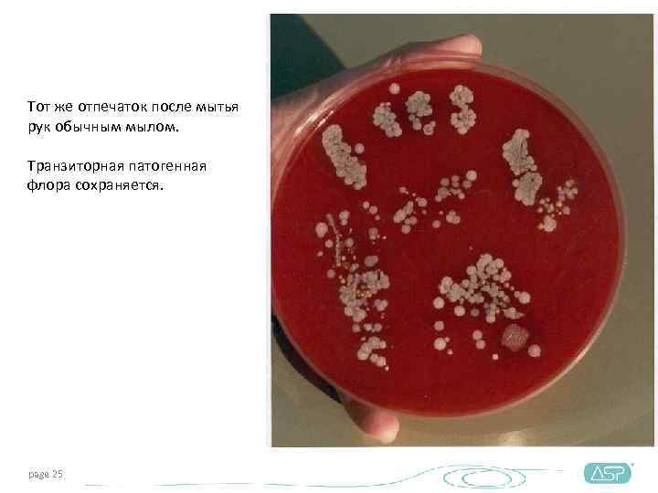 Тот же отпечаток после мытья рук обычным мылом.  Транзиторная патогенная флора сохраняется. page