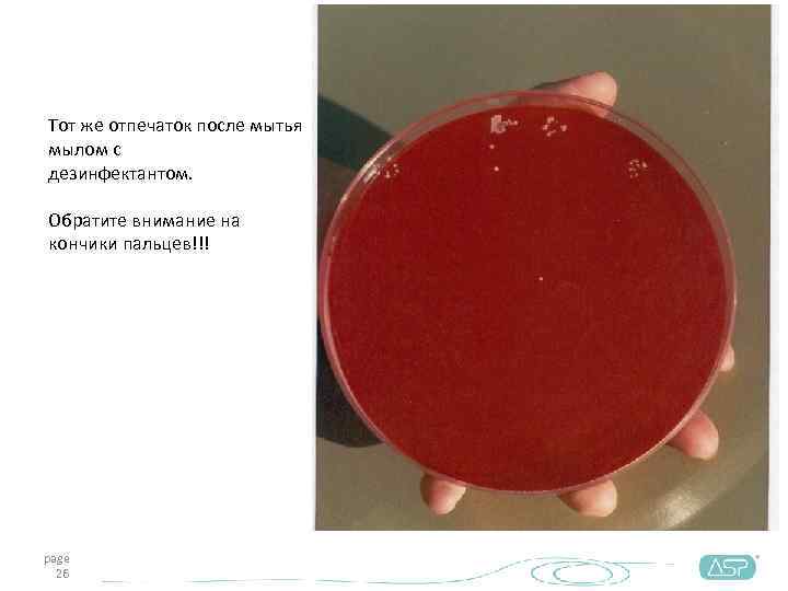 Тот же отпечаток после мытья мылом с дезинфектантом.  Обратите внимание на кончики пальцев!!!