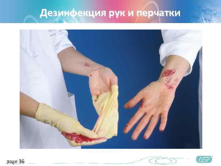    Дезинфекция рук и перчатки page 36 