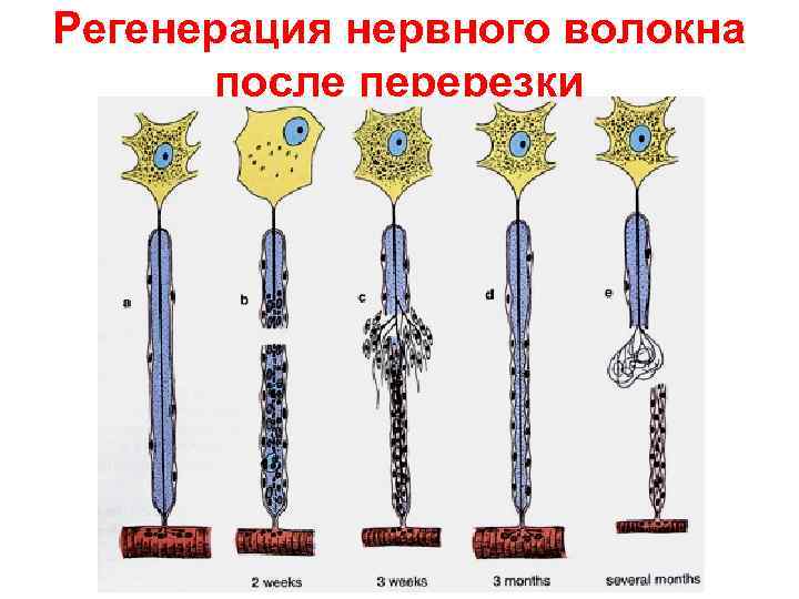 Регенерация нервного волокна  после перерезки 