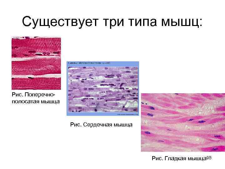   Существует три типа мышц: Рис. Поперечно- полосатая мышца    