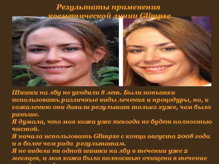 Результаты применения косметической линии Glimpse Шишки на лбу не уходили 8 Результаты применения косметической линии Glimpse Шишки на лбу не уходили 8
