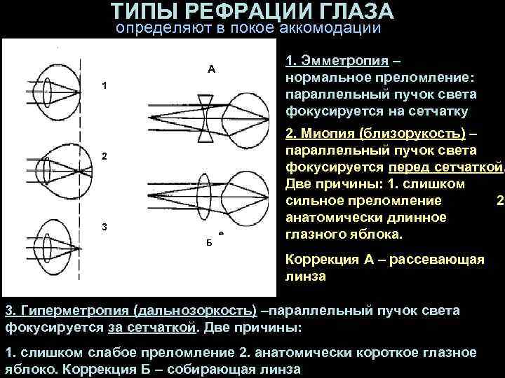 Схема хода лучей при дальнозоркости