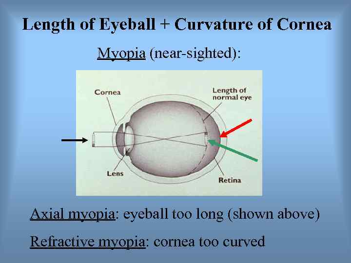 Length of Eyeball + Curvature of Cornea  Myopia (near-sighted):  Axial myopia: eyeball