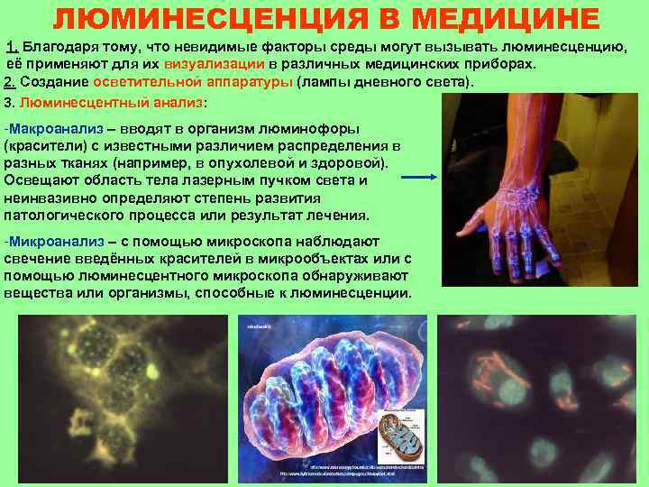  ЛЮМИНЕСЦЕНЦИЯ В МЕДИЦИНЕ 1. Благодаря тому, что невидимые факторы среды могут вызывать люминесценцию,
