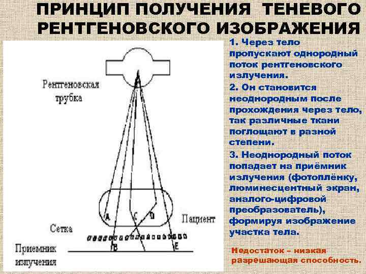 Принцип получения рентгеновского изображения