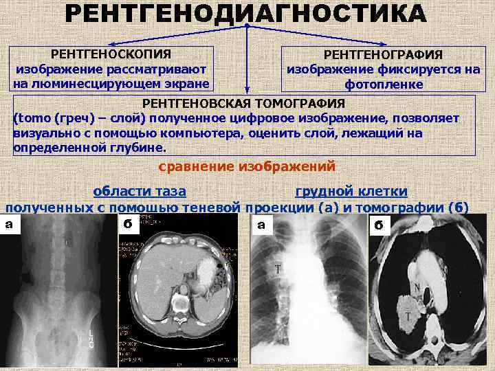 Рассмотрите рентгенограмму с изображением кисти человека как называют повреждение которое