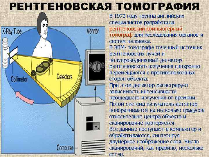 Рентгеновские методы изображения