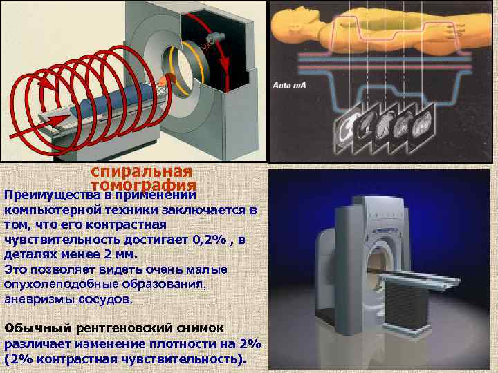 Контрастная чувствительность рентгеновского изображения