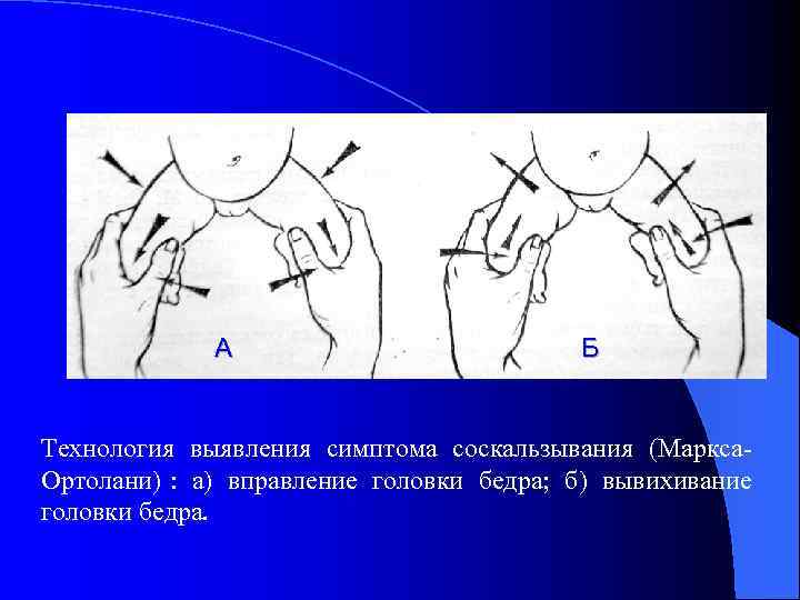    А      Б  Технология выявления симптома