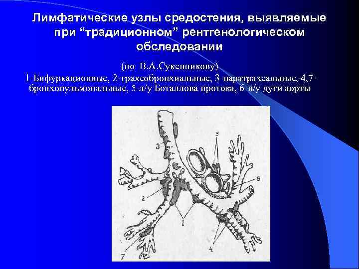  Лимфатические узлы средостения, выявляемые при “традиционном” рентгенологическом   обследовании   