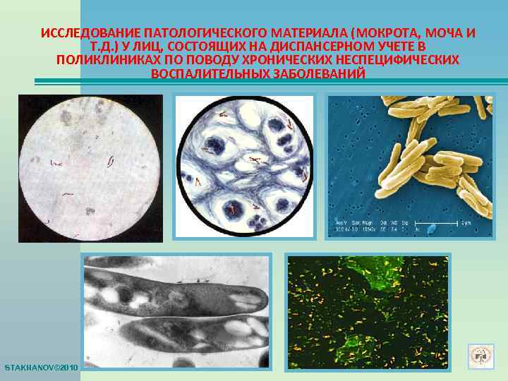  ИССЛЕДОВАНИЕ ПАТОЛОГИЧЕСКОГО МАТЕРИАЛА (МОКРОТА, МОЧА И   Т. Д. ) У ЛИЦ,