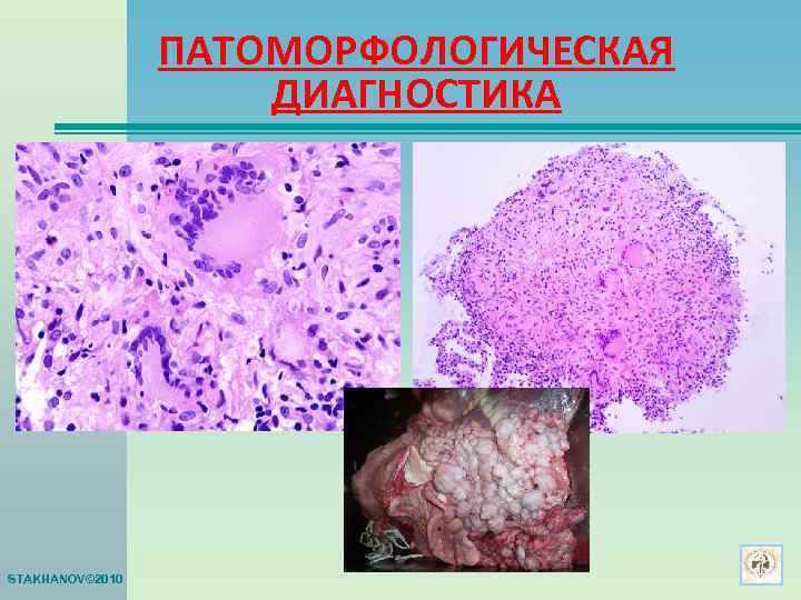    ПАТОМОРФОЛОГИЧЕСКАЯ     ДИАГНОСТИКА STAKHANOV© 2010 