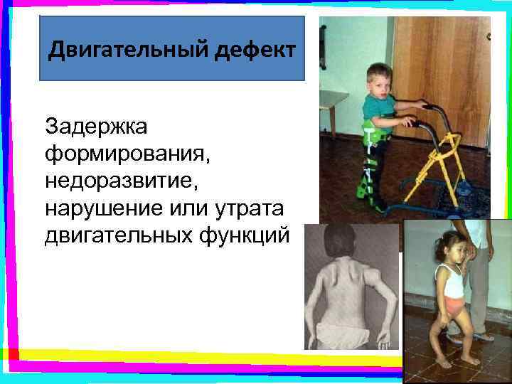 Двигательный дефект Задержка формирования, недоразвитие, нарушение или утрата двигательных функций 