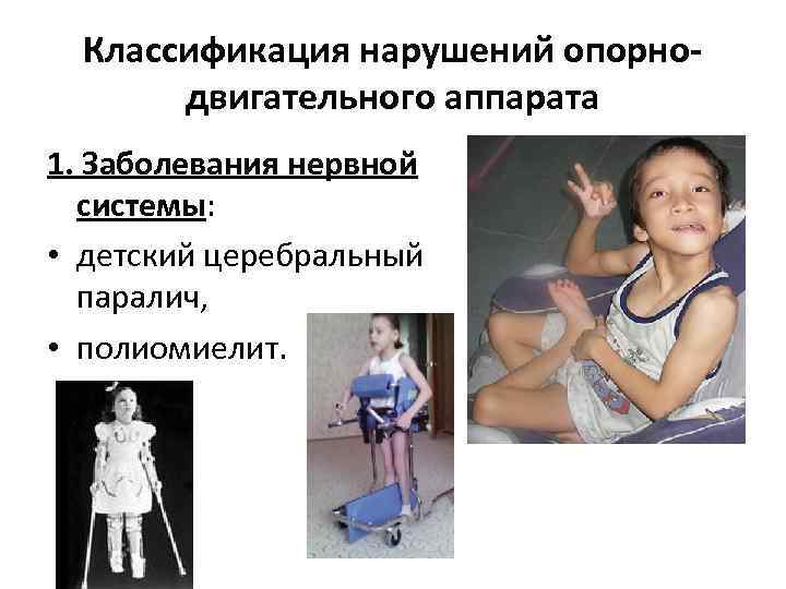  Классификация нарушений опорно-  двигательного аппарата 1. Заболевания нервной  системы:  •