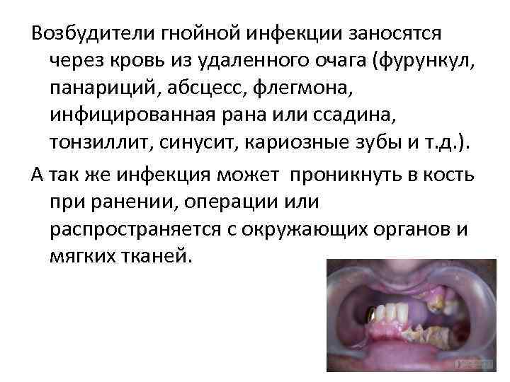 Возбудители гнойной инфекции заносятся  через кровь из удаленного очага (фурункул, панариций, абсцесс, флегмона,