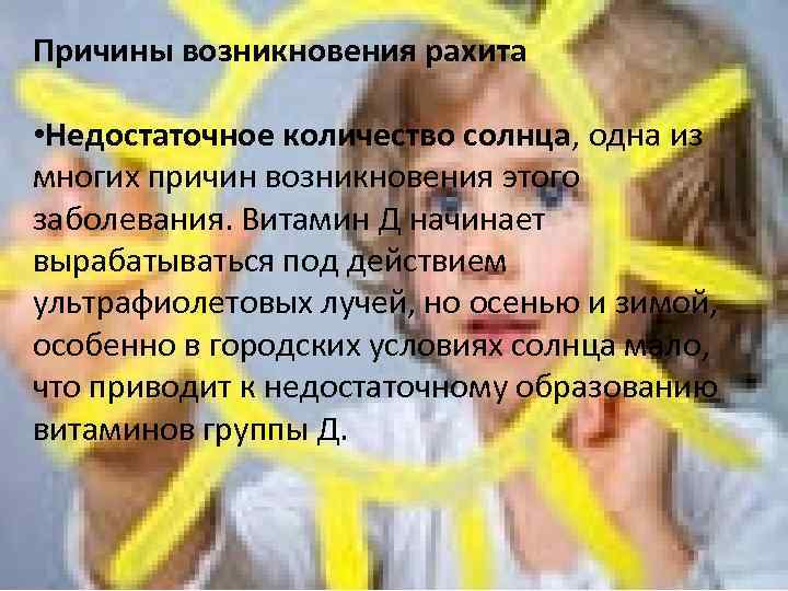 Причины возникновения рахита  • Недостаточное количество солнца, одна из многих причин возникновения этого