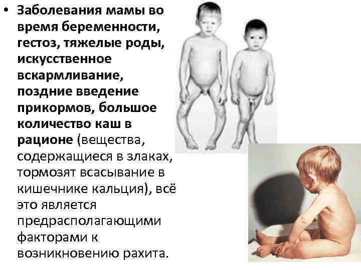  • Заболевания мамы во  время беременности, гестоз, тяжелые роды, искусственное  вскармливание,