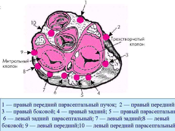 1 — правый передний парасептальный пучок; 2 — правый передний; 3 — правый боковой;