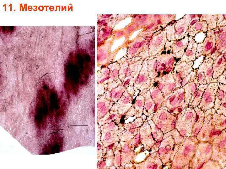 11. Мезотелий 11. Мезотелий