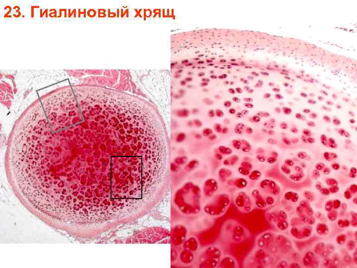 23. Гиалиновый хрящ 23. Гиалиновый хрящ