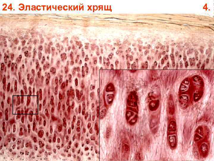24. Эластический хрящ 4. 24. Эластический хрящ 4.