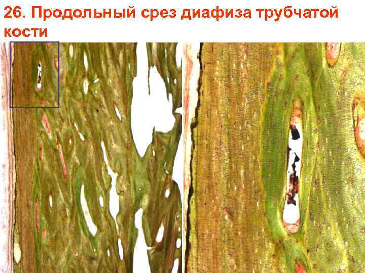 26. Продольный срез диафиза трубчатой кости 26. Продольный срез диафиза трубчатой кости