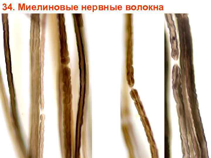 34. Миелиновые нервные волокна 34. Миелиновые нервные волокна