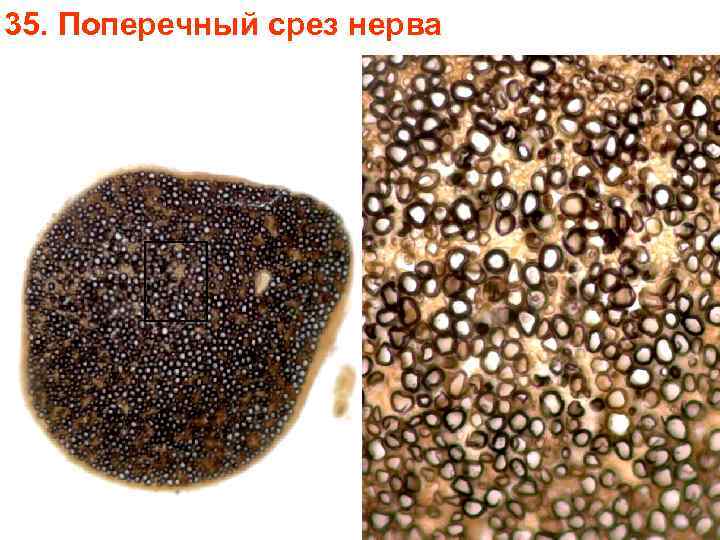 35. Поперечный срез нерва 35. Поперечный срез нерва