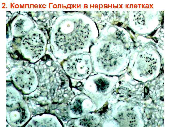 2. Комплекс Гольджи в нервных клетках 2. Комплекс Гольджи в нервных клетках