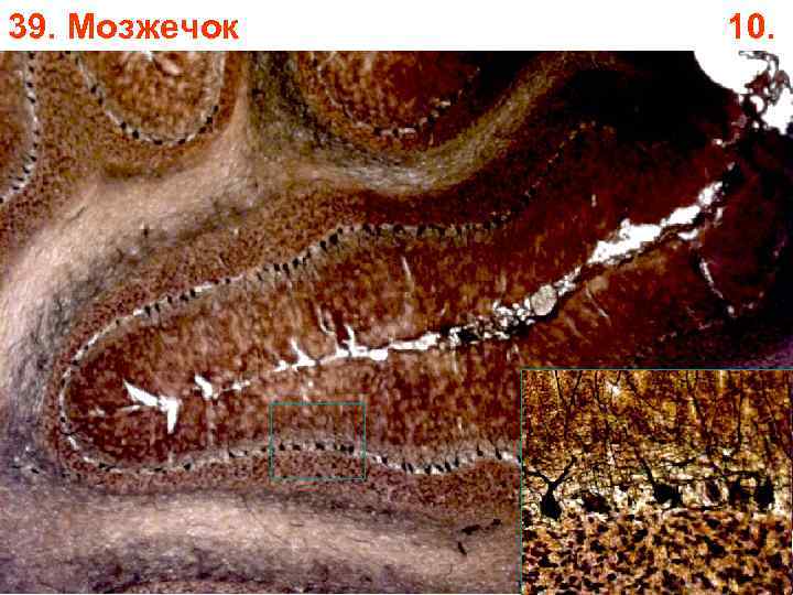 39. Мозжечок 10. 39. Мозжечок 10.