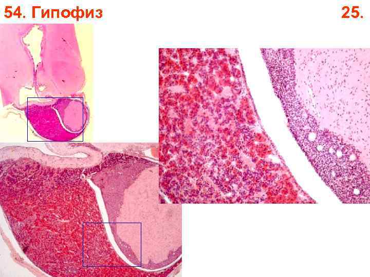 54. Гипофиз 25. 54. Гипофиз 25.