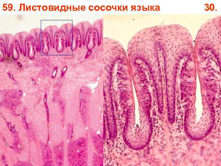 59. Листовидные сосочки языка 30. 59. Листовидные сосочки языка 30.