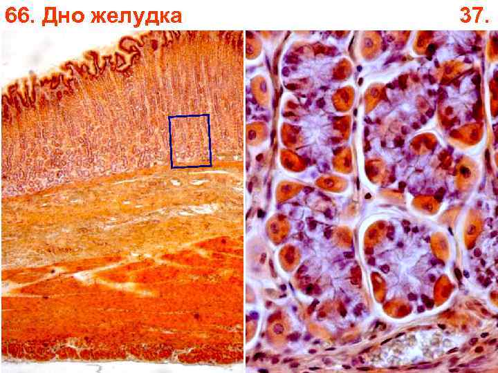 66. Дно желудка 37. 66. Дно желудка 37.