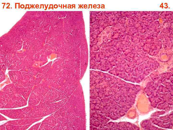 72. Поджелудочная железа 43. 72. Поджелудочная железа 43.