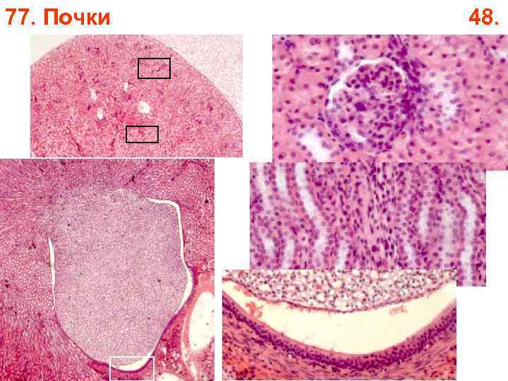 77. Почки 48. 77. Почки 48.
