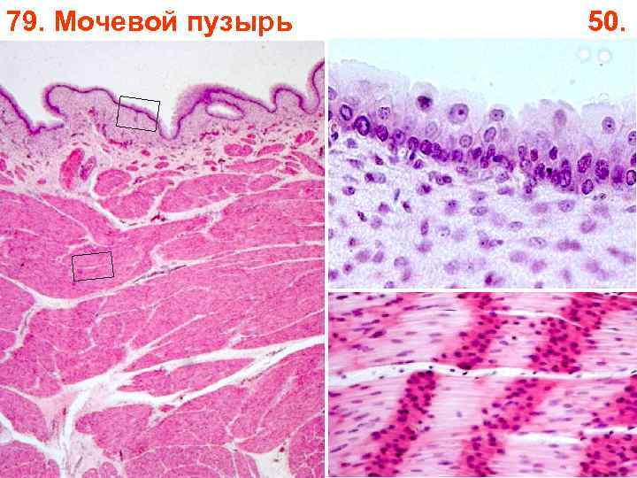 79. Мочевой пузырь 50. 79. Мочевой пузырь 50.